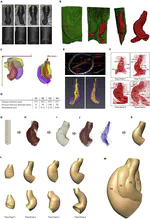 Spatiotemporal patterns in the embryonic heart