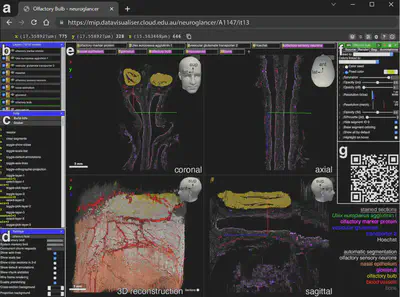 Neuroglancer screenshot placeholder